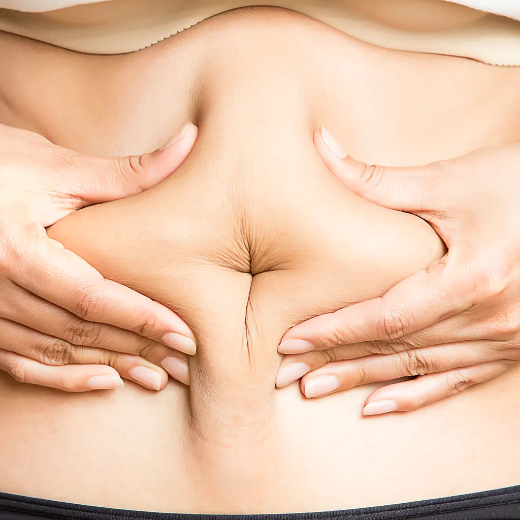 Λιποαναρρόφηση – Λιπογλυπτική