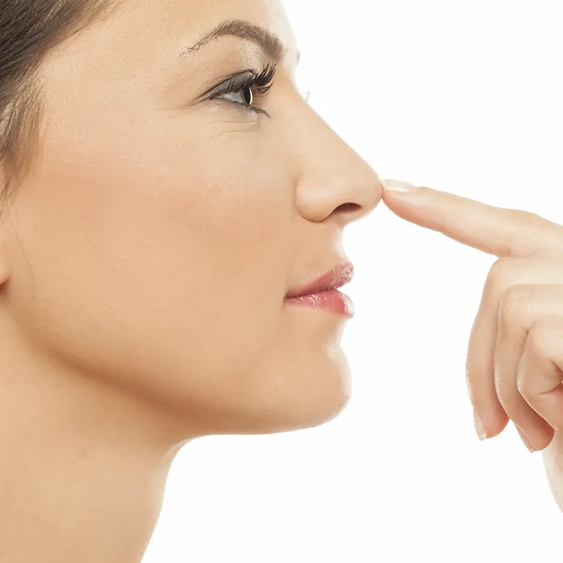 Ρινοπλαστική