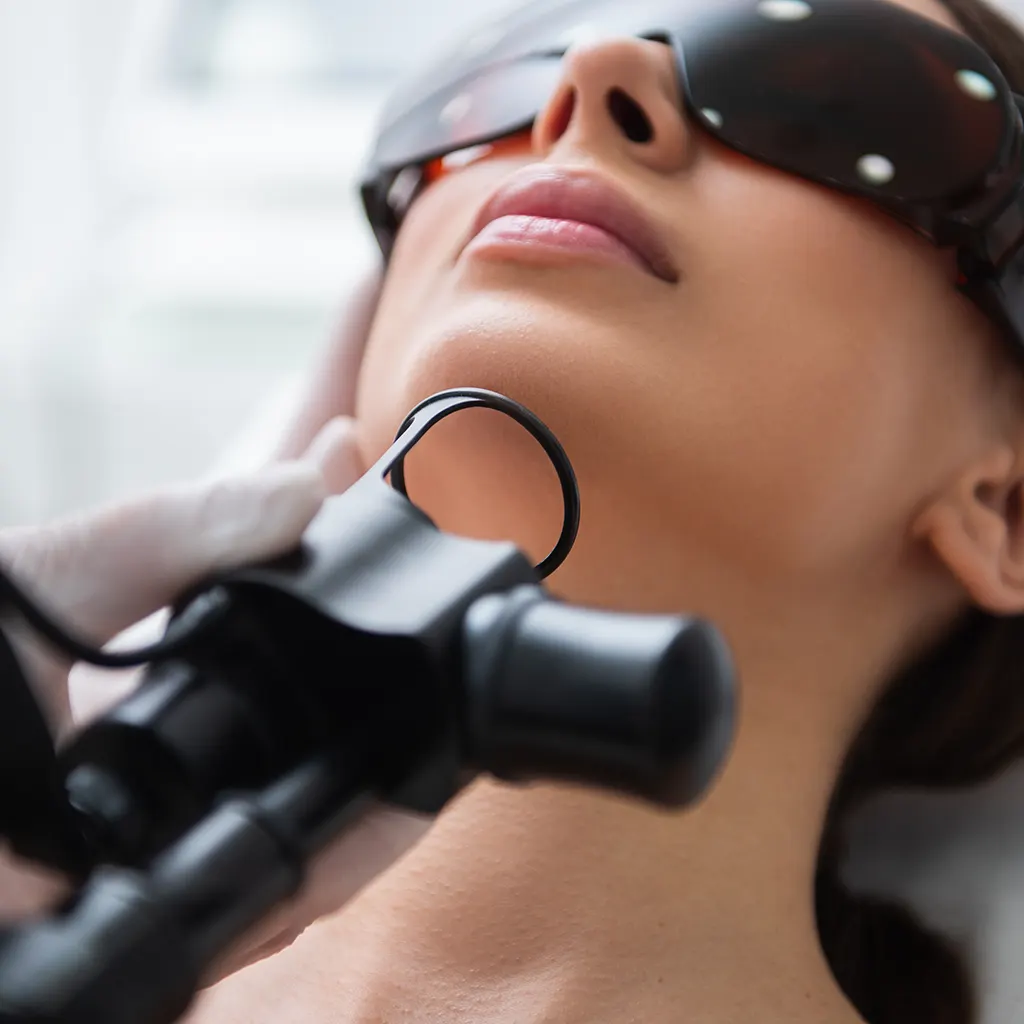Fractional CO₂ Laser: Ανάπλαση, Αντιγήρανση & Λάμψη σε Βάθος