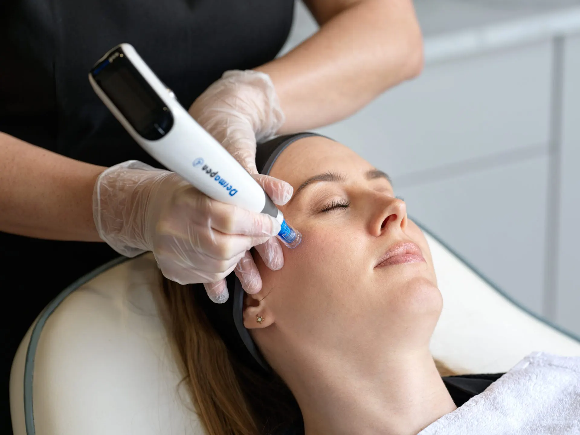 Dermapen 4 and Advanced Microneedling