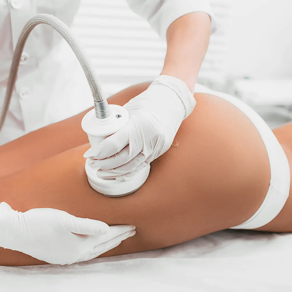 Body Mesotherapy for Localised Fat