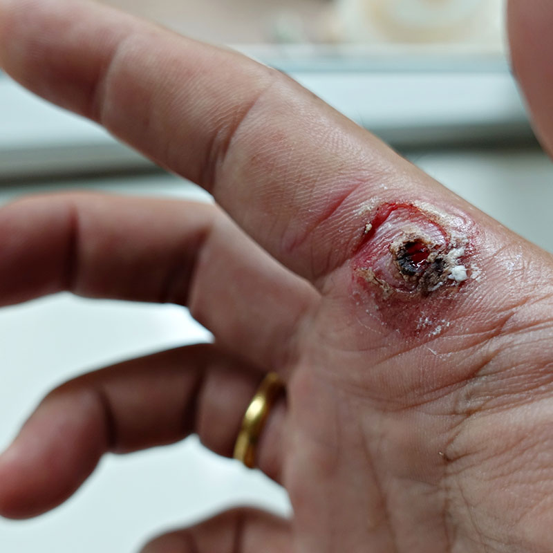 Conditions and Reconstruction of the Hand