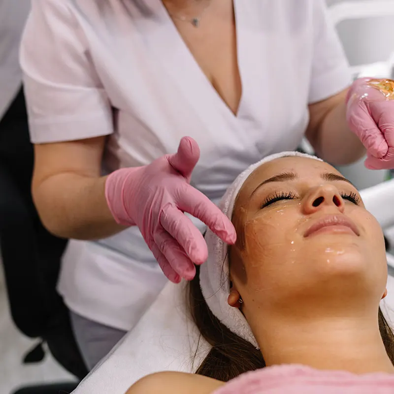 Χημικό Peeling: Εξατομικευμένη Απολέπιση για Ασφαλή και Αποτελεσματική Ανανέωση του Δέρματος