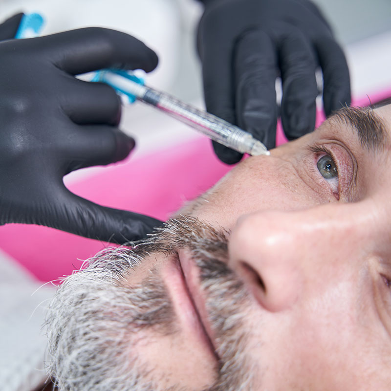 Botox – Θεραπείες για άνδρες